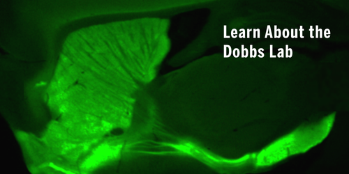 Dobbs